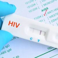 رپید تست ایدز RAPID HIV Test 2023